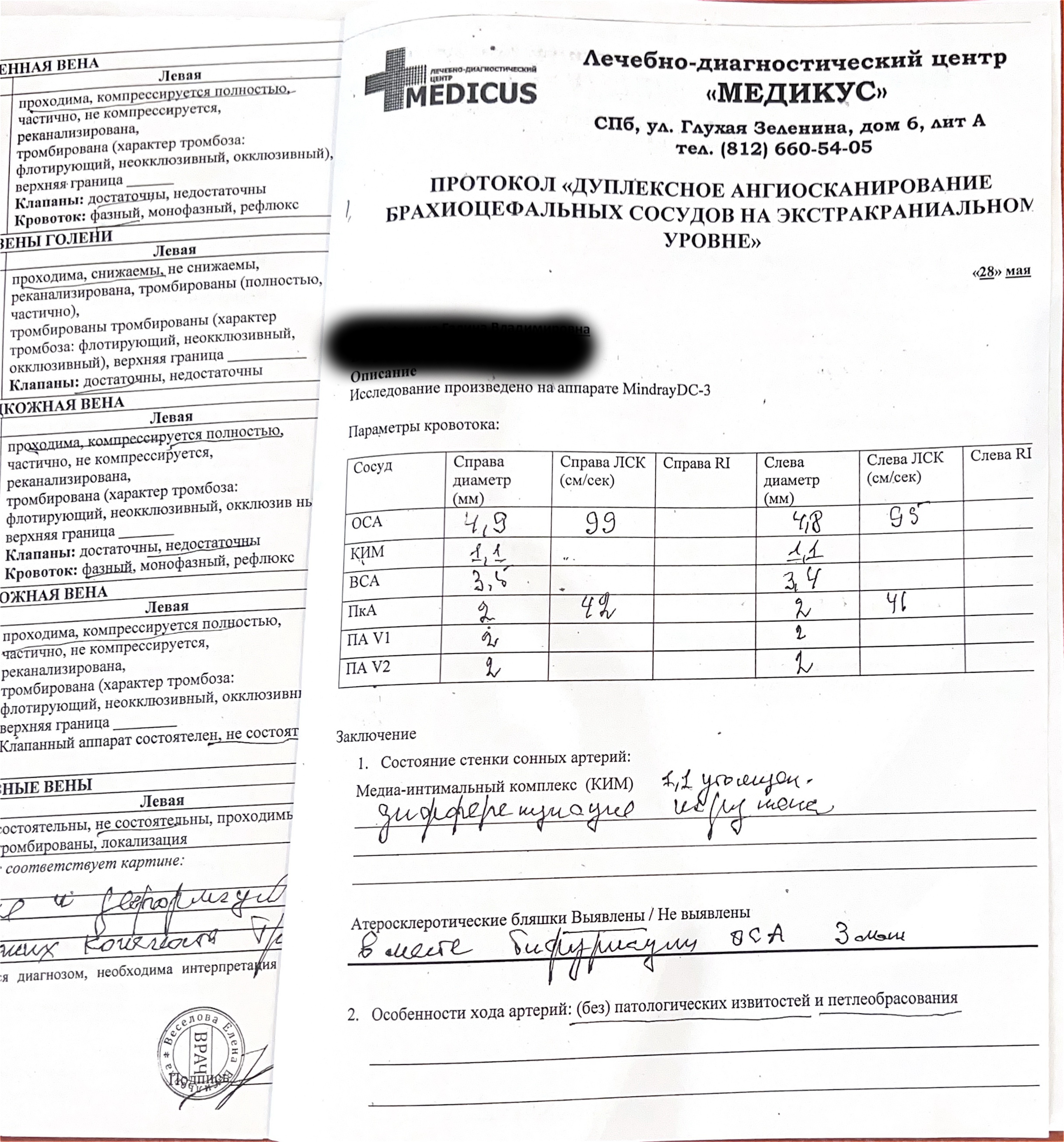 УЗИ БЦА на Петроградской стороне
