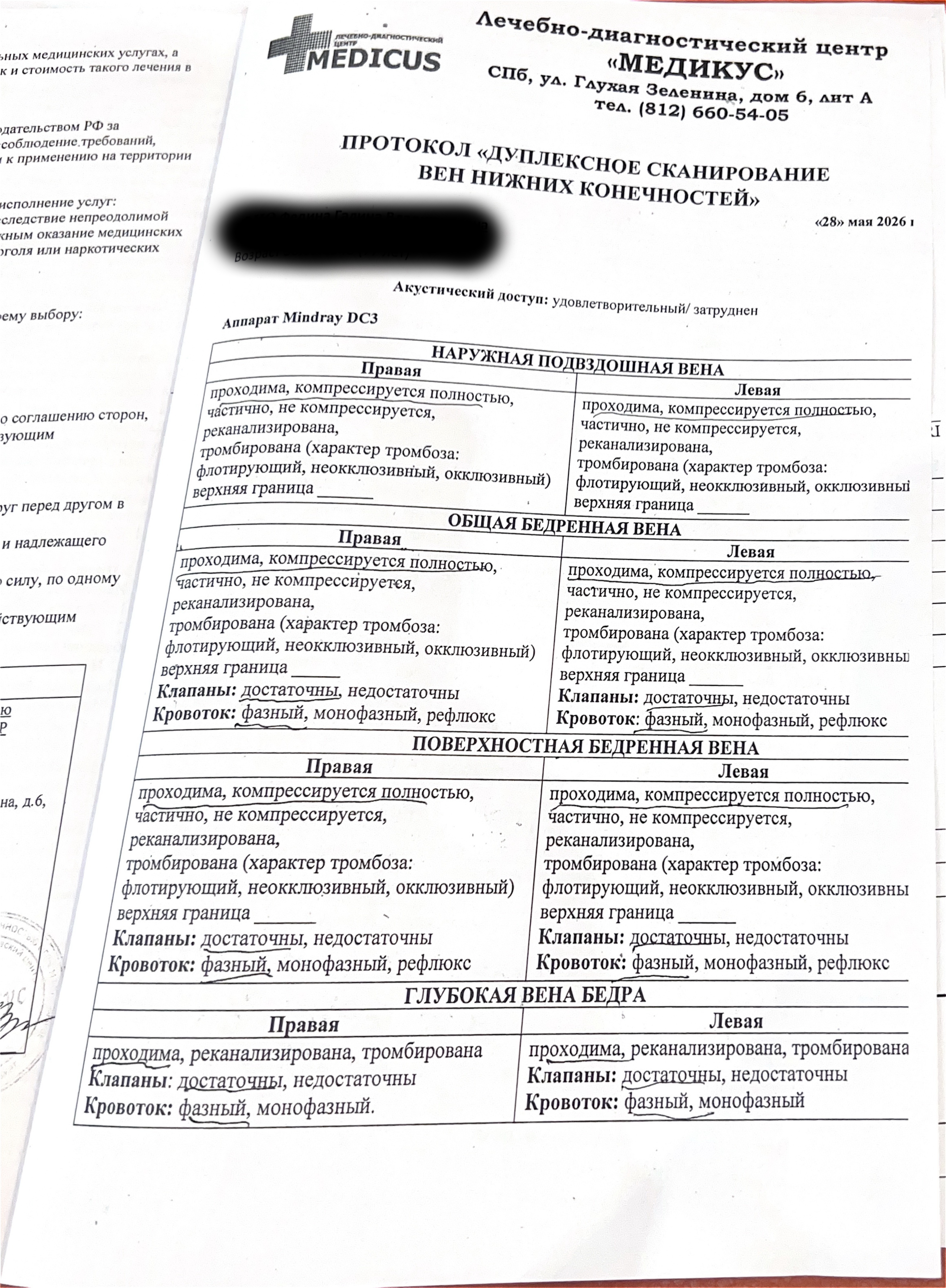 УЗИ вен нижних конечностей в СПб
