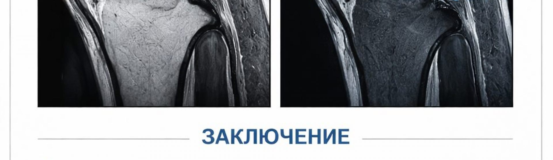 Как читать МРТ коленного сустава: пошаговая азбука для пациента | Советы главного врача Донского Э.О.