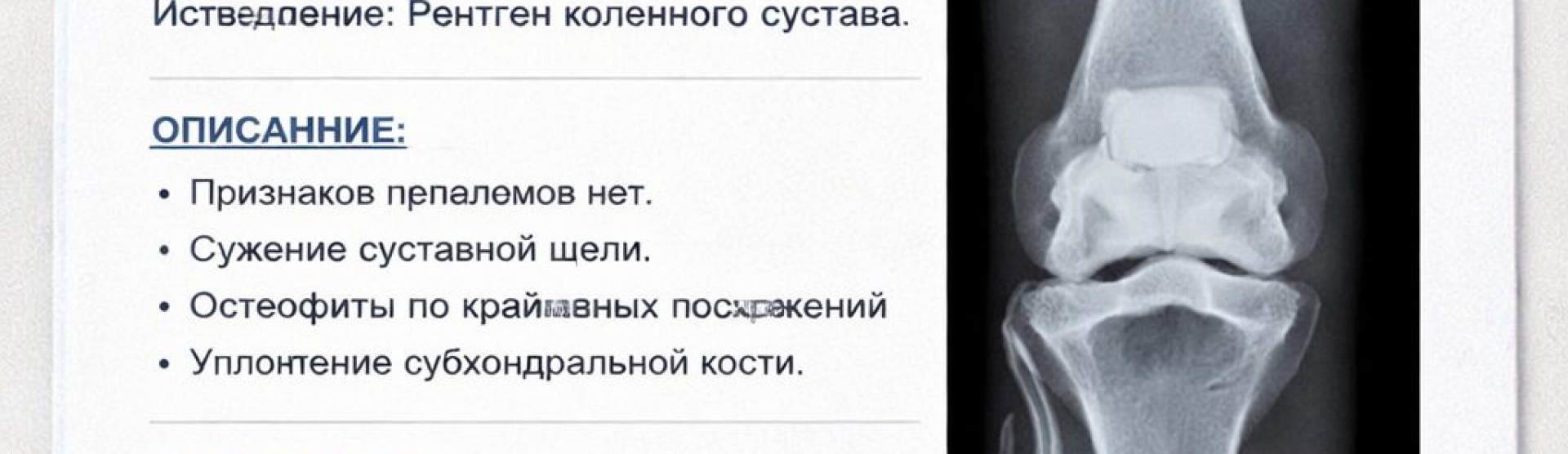 Как читать заключение рентгенолога: расшифровка терминов для пациента | Советы главного врача Донского Э.О.
