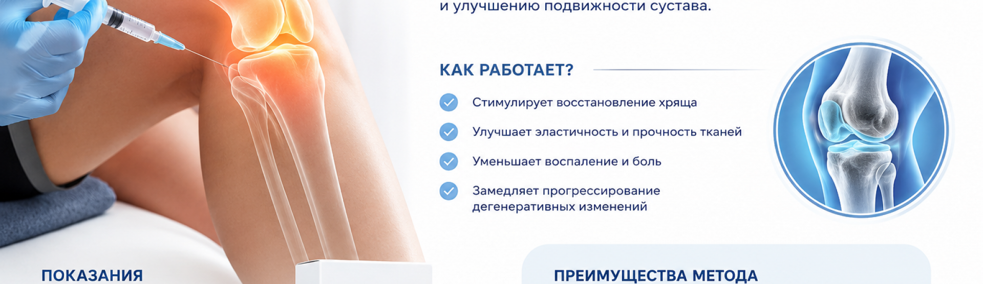 Подготовка к коллагенотерапии коленного сустава | Клиника Медикус