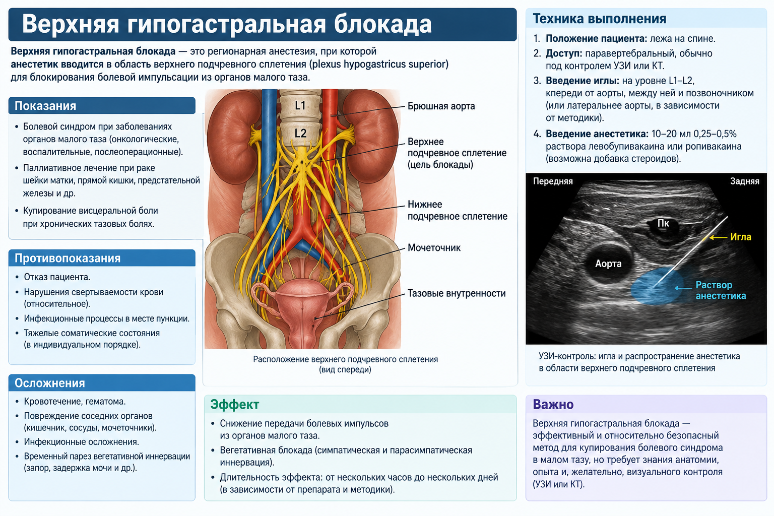 Верхняя гипогастральная блокада — когда тазовая боль отступает без операции