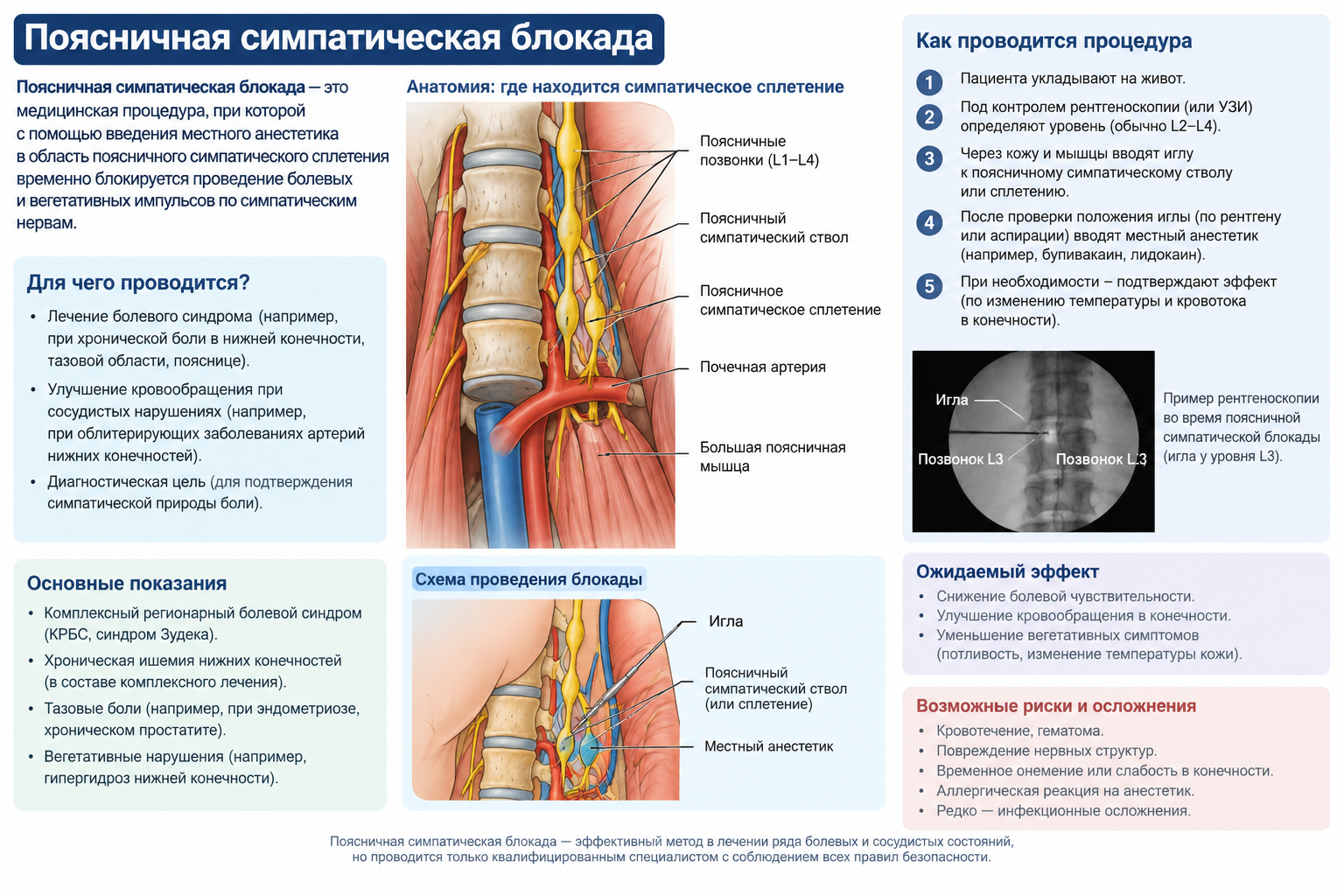 Поясничная симпатическая блокада — когда боль в ногах отступает без операции
