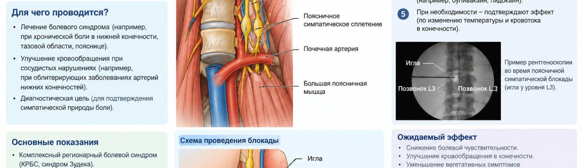 Поясничная симпатическая блокада у м. Чкаловская, Спортивная, Горьковская, Петроградская, Крестовский остров