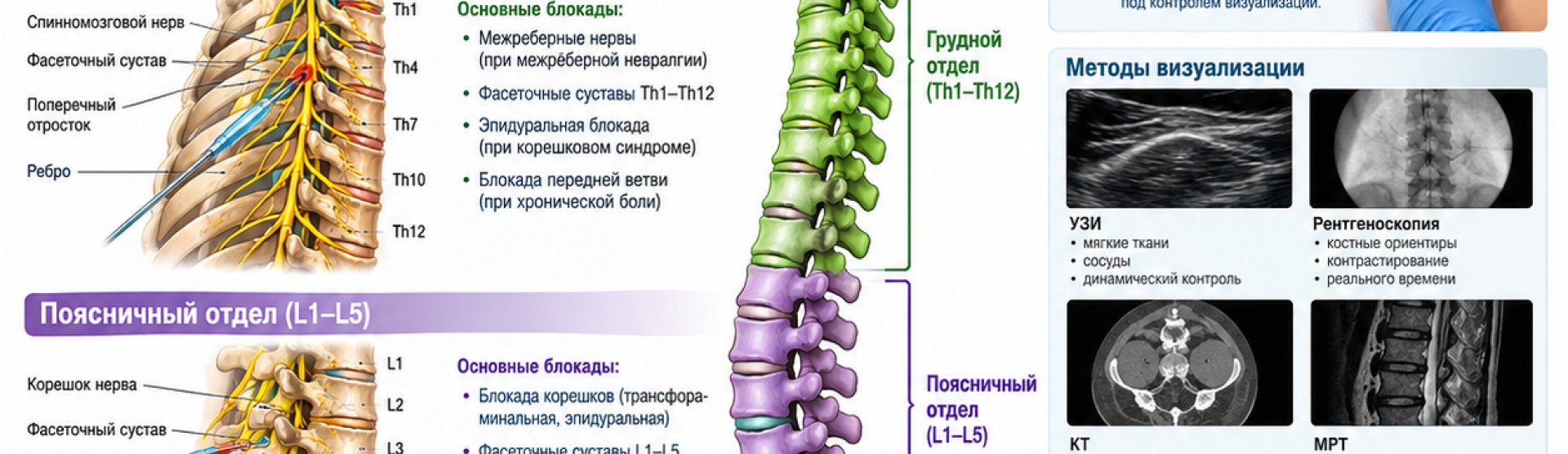 Сверхточные блокады в вертеброневрологии у м. Чкаловская, Спортивная, Горьковская, Петроградская, Крестовский остров
