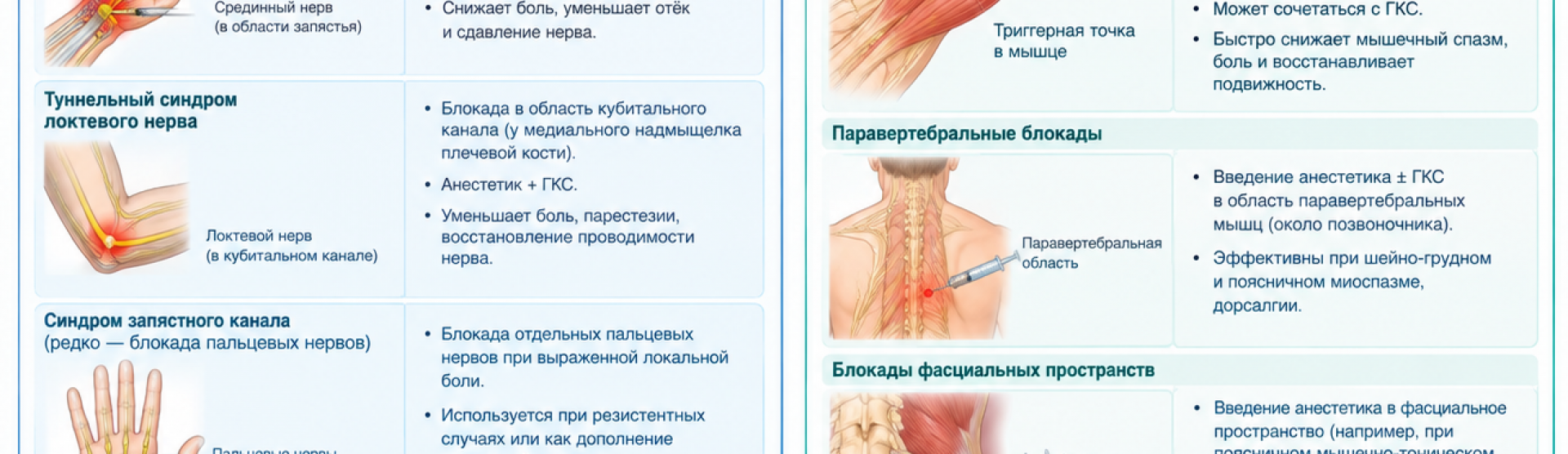 Редкие блокады при туннельных и мышечно-тонических синдромах у м. Чкаловская, Спортивная, Горьковская, Петроградская, Крестовский остров
