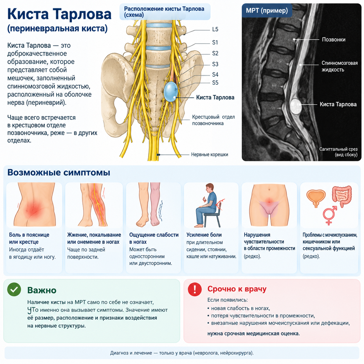 Периневральная киста крестцового отдела (киста Тарлова): невролог с опытом более 20 лет о «водяном пузыре» на нервных корешках Периневральная киста крестцового отдела (киста Тарлова): невролог с опытом более 20 лет о «водяном пузыре» на нервных корешках
