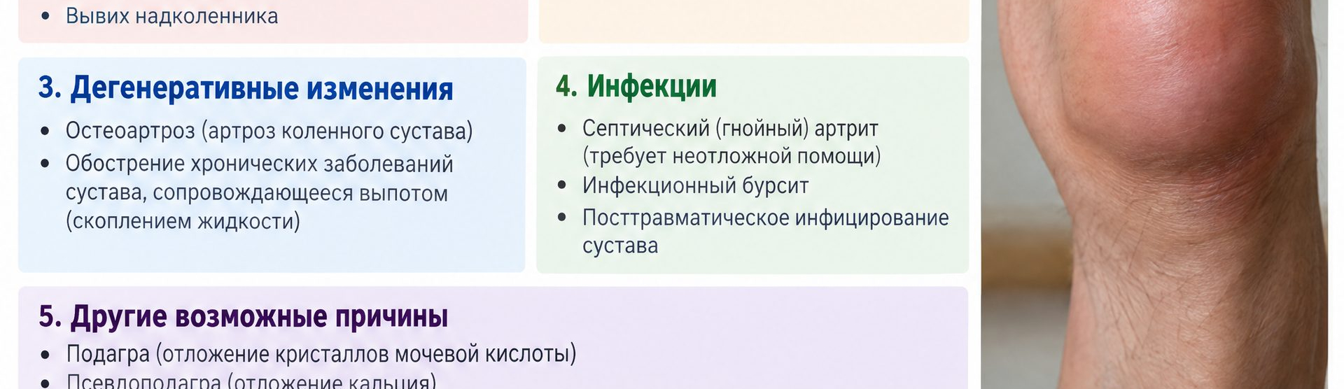 Колено отекло и не сгибается — 5 причин от ортопеда | Лечение в СПб, Донской Э.О.